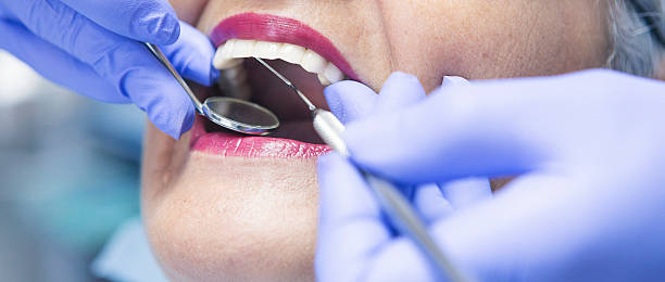 Best Emergency Treatment for Dental Infections or Abscesses in Egypt Lake Leto, FL